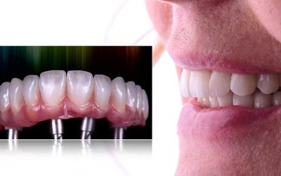 ZUBNI TEHNICARI - PINK&WHITE - DENI PAVLOVIC - 22/23 MAJ