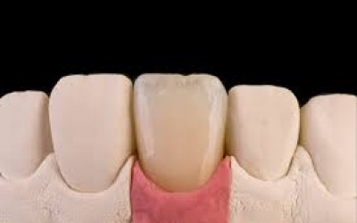 ZUBNI TEHNICARI - CUT-BACK - ANDREJ LAZIC - 28. i 29. MART