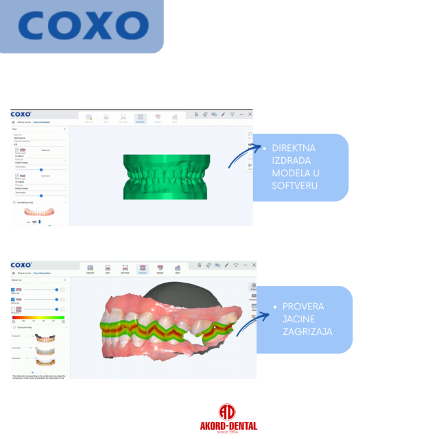 Intraoralni Skener - Coxo + Dental Cart Intraoralni Skener - Coxo + Dental Cart