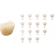 Zirconia Disc Explore Functional (Trans. 43%-46,5%, 1027Mpa-1300Mpa) Upcera